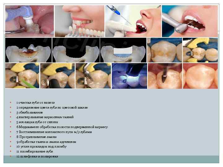  1 очистка зуба от налета 2 определение цвета зуба по цветовой шкале 3