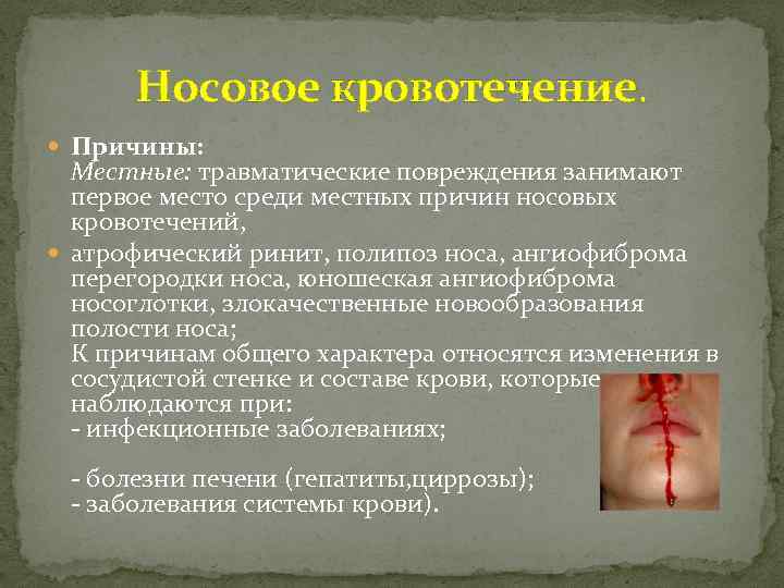 Носовое кровотечение. Причины: Местные: травматические повреждения занимают первое место среди местных причин носовых кровотечений,