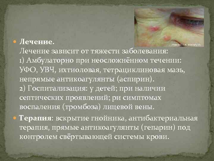  Лечение зависит от тяжести заболевания: 1) Амбулаторно при неосложнённом течении: УФО, УВЧ, ихтиоловая,