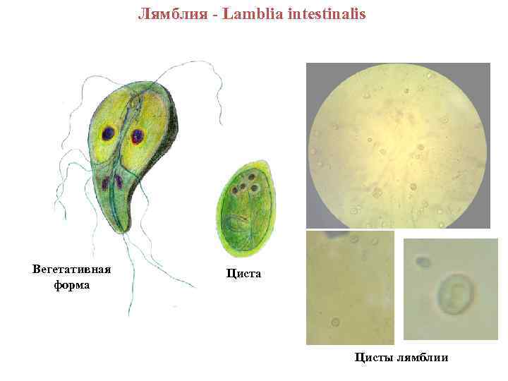 Лямблия - Lamblia intestinalis Вегетативная форма Цисты лямблии 