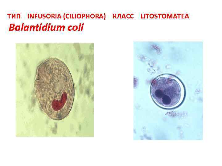 ТИП INFUSORIA (CILIOPHORA) КЛАСС LITOSTOMATEA Balantidium coli 