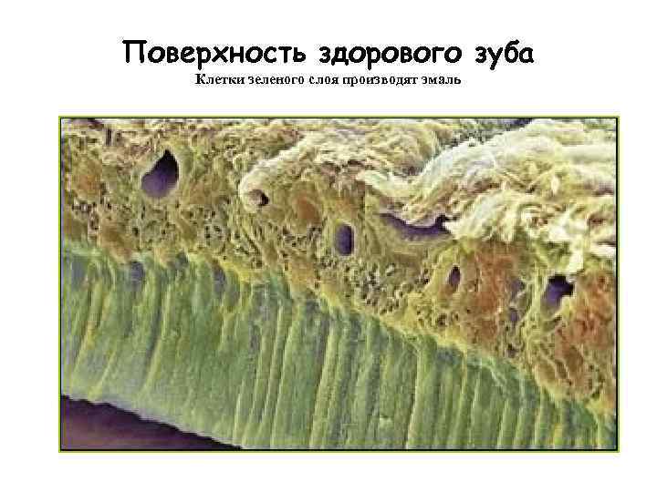 Поверхность здорового зуба Клетки зеленого слоя производят эмаль 