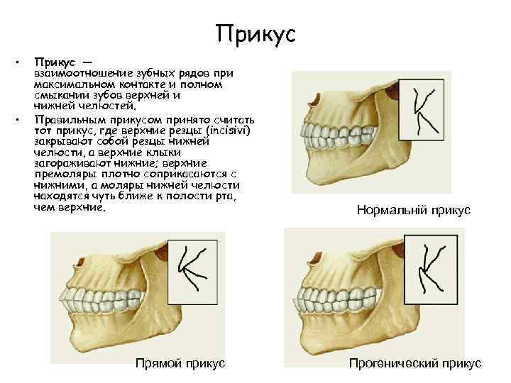 Прикус • • Прикус — взаимоотношение зубных рядов при максимальном контакте и полном смыкании