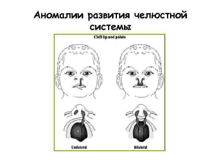 Аномалии развития челюстной системы 