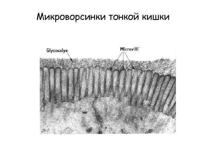 Микроворсинки тонкой кишки 