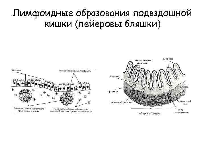 Пейеровы бляшки