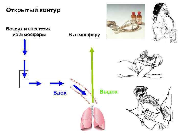 Открытый контур Воздух и анестетик из атмосферы В атмосферу Вдох Выдох 