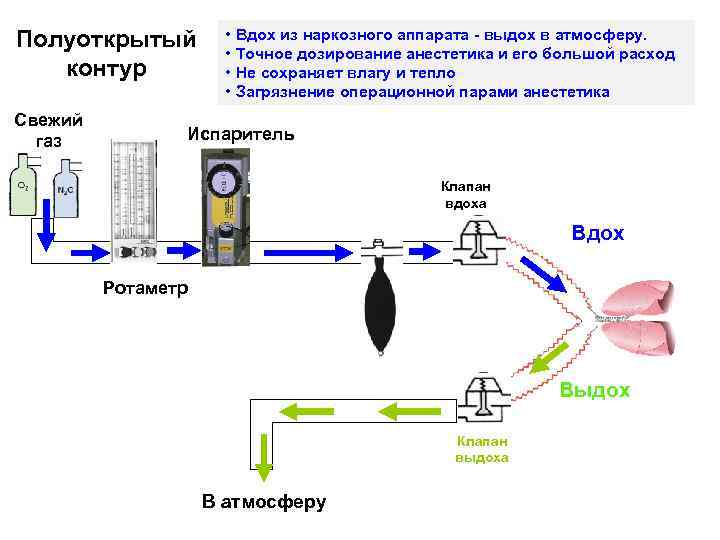 Открытая и закрытая подачи. Полузакрытый контур наркозного аппарата. Полуоткрытый контур наркозного аппарата. Реверсивный контур наркозного аппарата. Дыхательный контур наркозного аппарата.