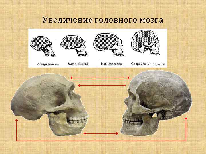 Увеличение головного мозга 