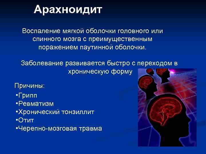 Арахноидит Воспаление мягкой оболочки головного или спинного мозга с преимущественным поражением паутинной оболочки. Заболевание