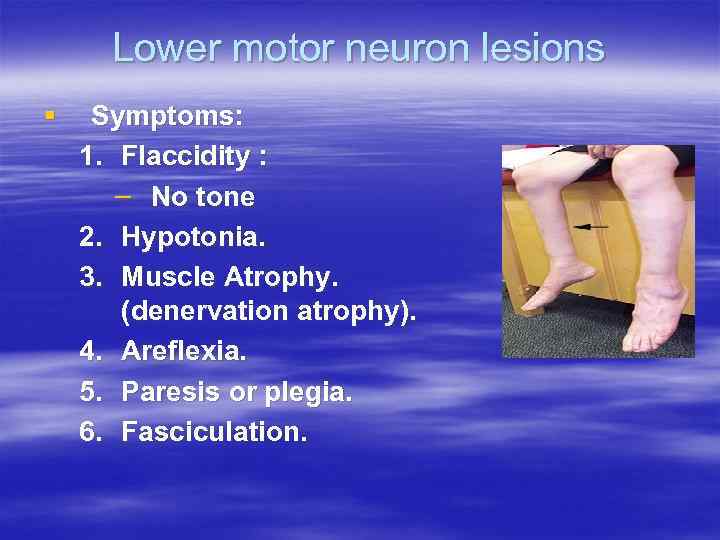 Lower motor neuron lesions § Symptoms: 1. Flaccidity : – No tone 2. Hypotonia.