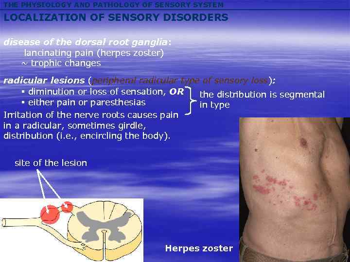 THE PHYSIOLOGY AND PATHOLOGY OF SENSORY SYSTEM LOCALIZATION OF SENSORY DISORDERS disease of the