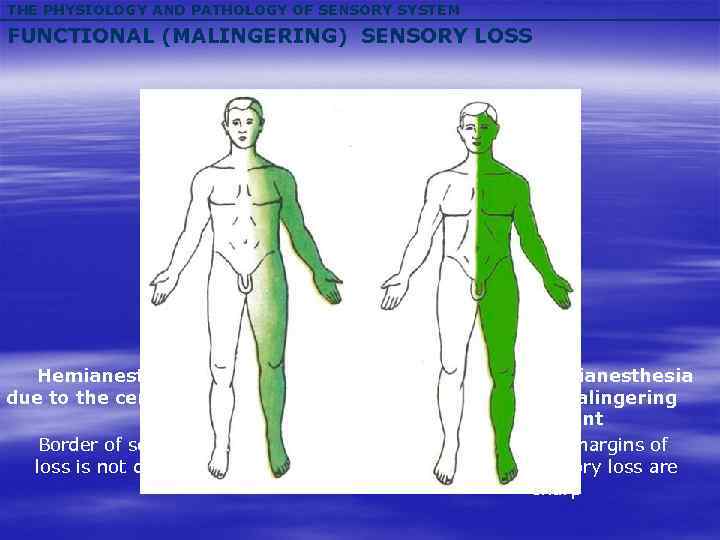 THE PHYSIOLOGY AND PATHOLOGY OF SENSORY SYSTEM FUNCTIONAL (MALINGERING) SENSORY LOSS Hemianesthesia due to
