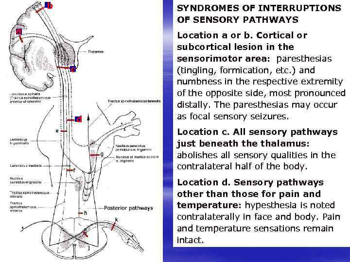 b SYNDROMES OF INTERRUPTIONS OF SENSORY PATHWAYS a Location a or b. Cortical or