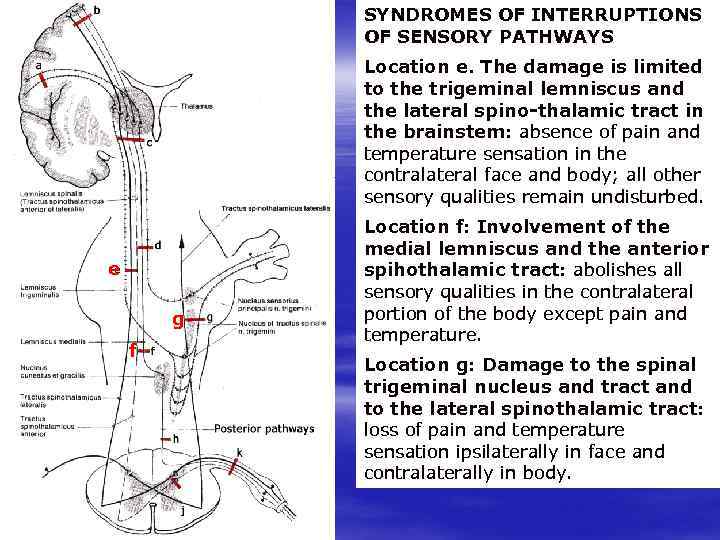 SYNDROMES OF INTERRUPTIONS OF SENSORY PATHWAYS Location e. The damage is limited to the