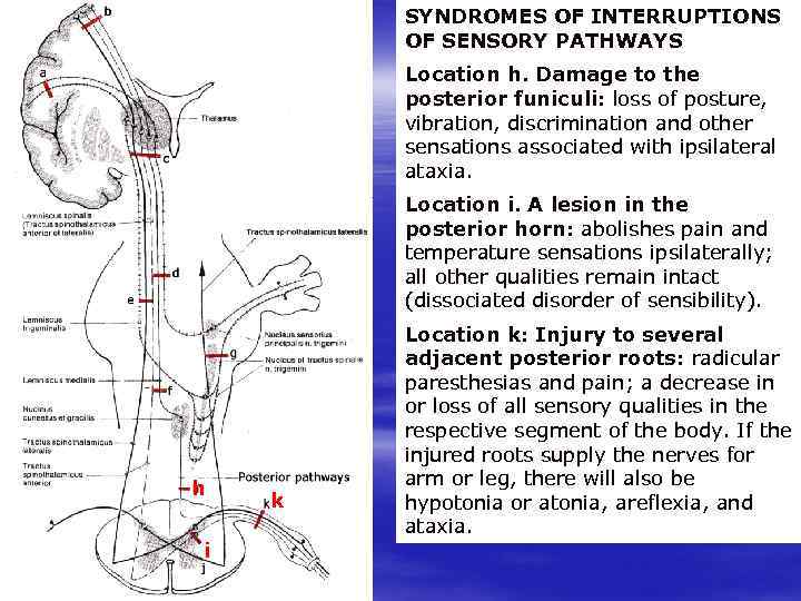 SYNDROMES OF INTERRUPTIONS OF SENSORY PATHWAYS Location h. Damage to the posterior funiculi: loss