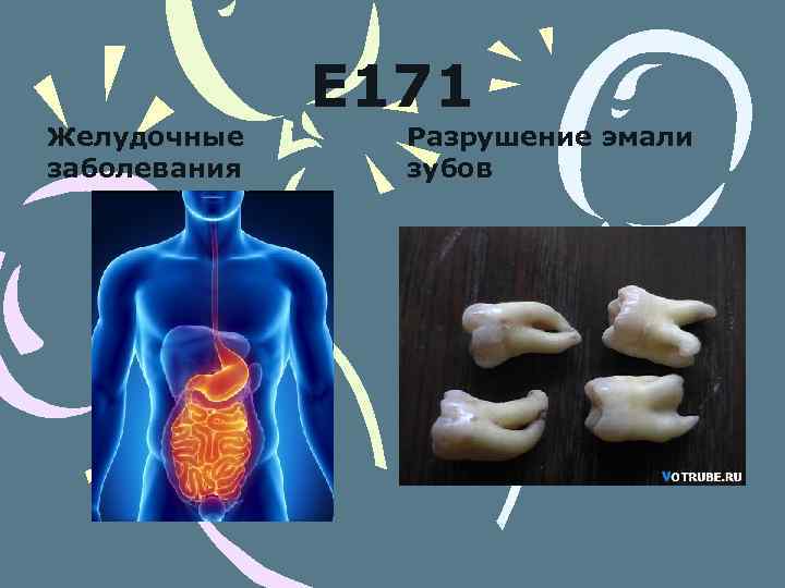 Е 171 Желудочные заболевания Разрушение эмали зубов 