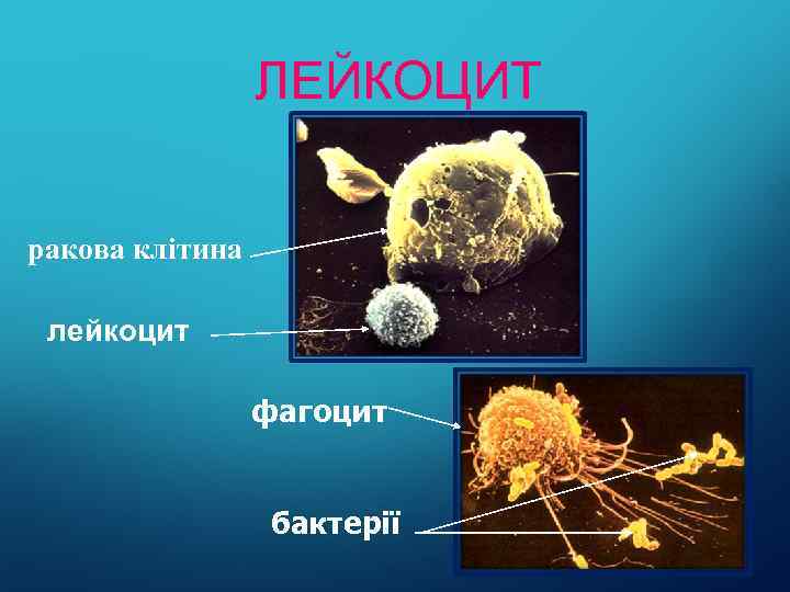 ЛЕЙКОЦИТ ракова клітина лейкоцит фагоцит бактерії 