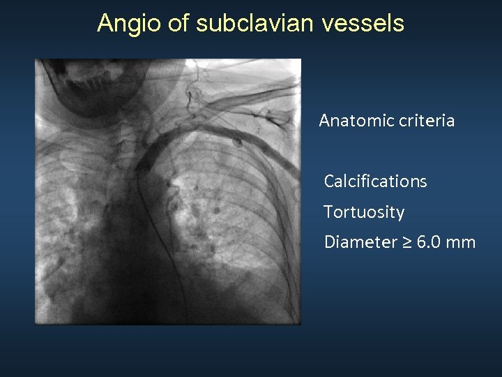 Angio of subclavian vessels Anatomic criteria Calcifications Tortuosity Diameter ≥ 6. 0 mm 