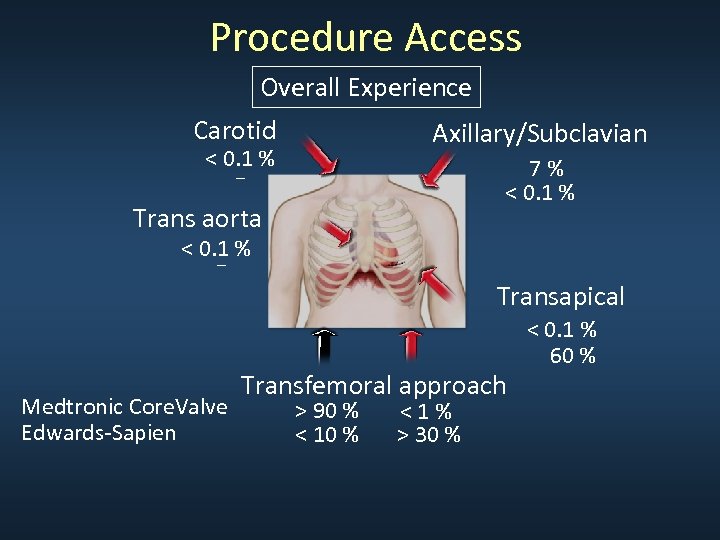 Procedure Access Overall Experience Carotid Axillary/Subclavian < 0. 1 % _ 7% < 0.