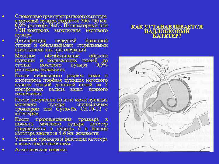 Засорение мочевого катетера карта вызова смп