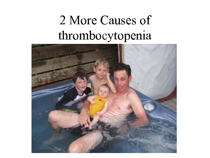 2 More Causes of thrombocytopenia 