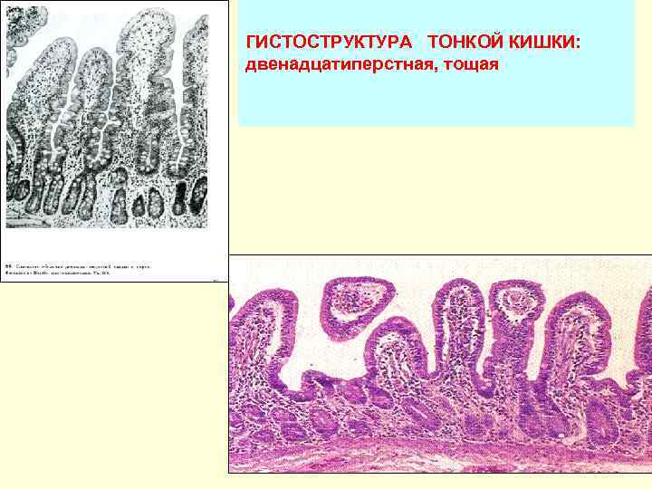 ГИСТОСТРУКТУРА ТОНКОЙ КИШКИ: двенадцатиперстная, тощая 