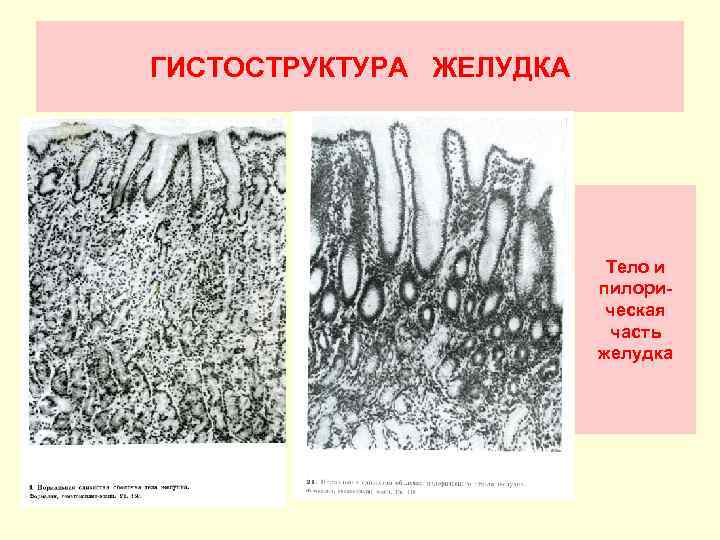 Пилорический отдел желудка гистология рисунок