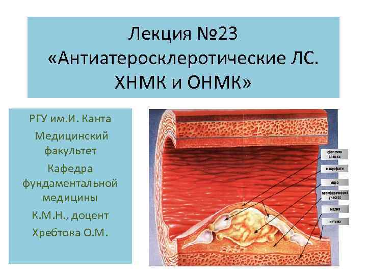 Лекция № 23 «Антиатеросклеротические ЛС. ХНМК и ОНМК» РГУ им. И. Канта Медицинский факультет