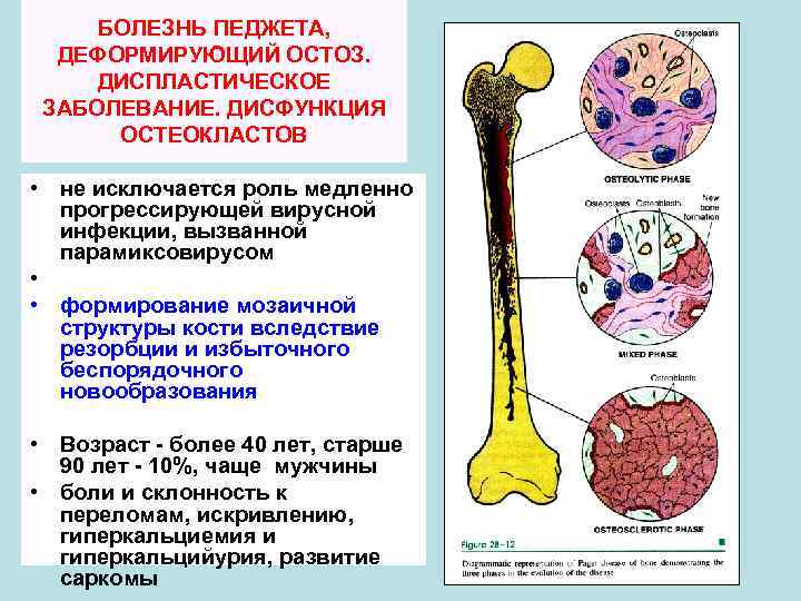 Уровская болезнь картинки