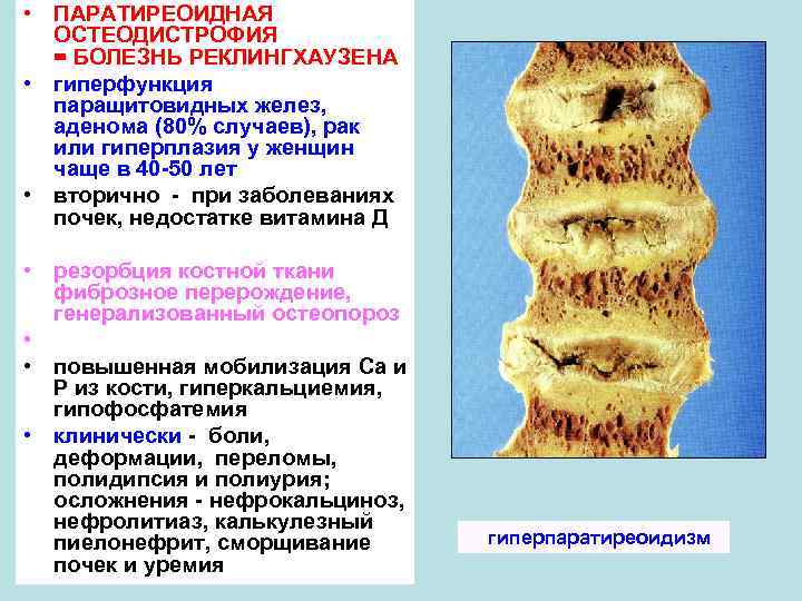 Наследственная остеодистрофия альбрехта презентация