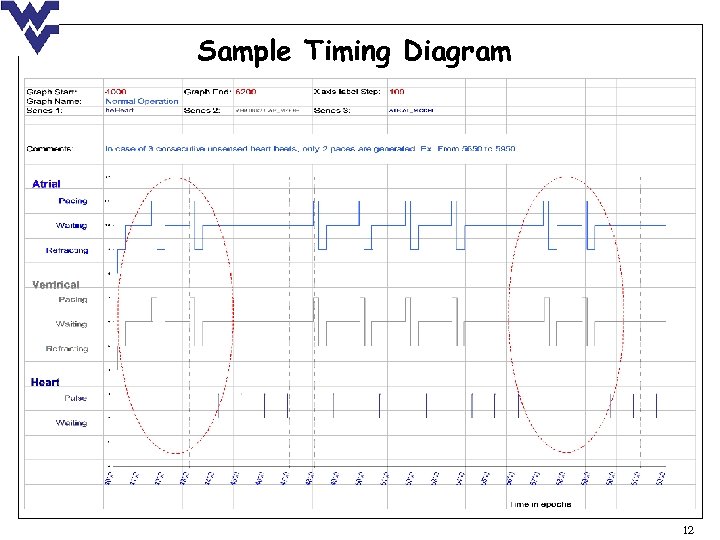Sample Timing Diagram 12 
