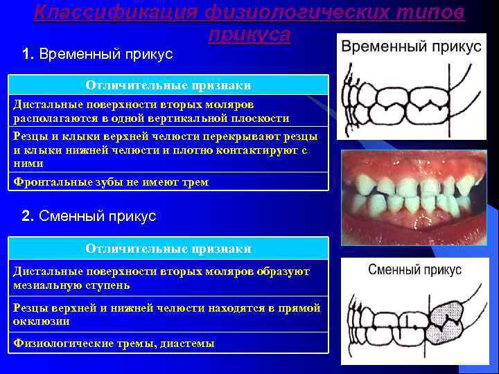 Временная окклюзия