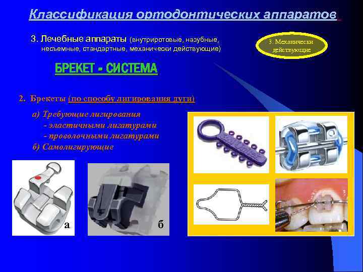 Ортодонтические аппараты механического действия презентация