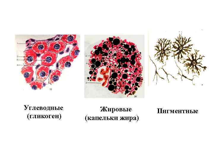 Углеводные (гликоген) Жировые (капельки жира) Пигментные 