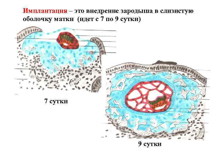 Имплантация – это внедрение зародыша в слизистую оболочку матки (идет с 7 по 9