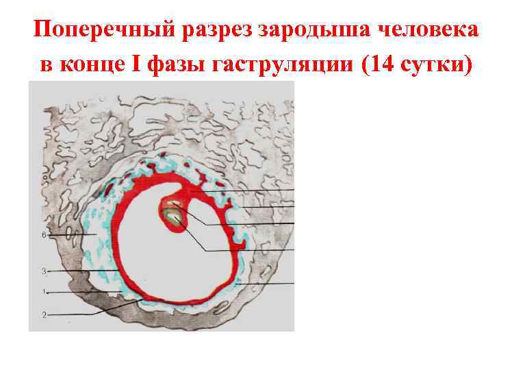 Поперечный разрез зародыша человека в конце I фазы гаструляции (14 сутки) 