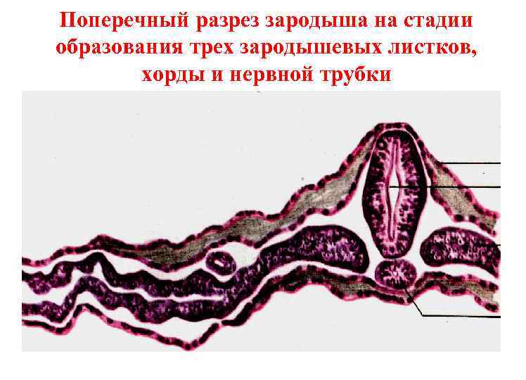 Поперечный разрез зародыша на стадии образования трех зародышевых листков, хорды и нервной трубки 