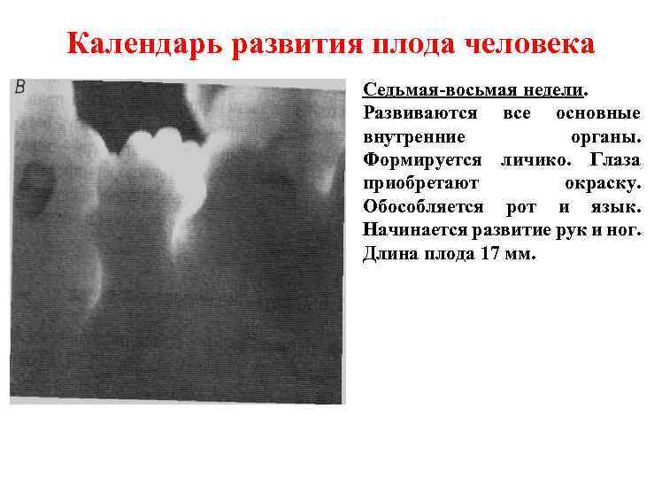 Календарь развития плода человека Седьмая-восьмая недели. Развиваются все основные внутренние органы. Формируется личико. Глаза