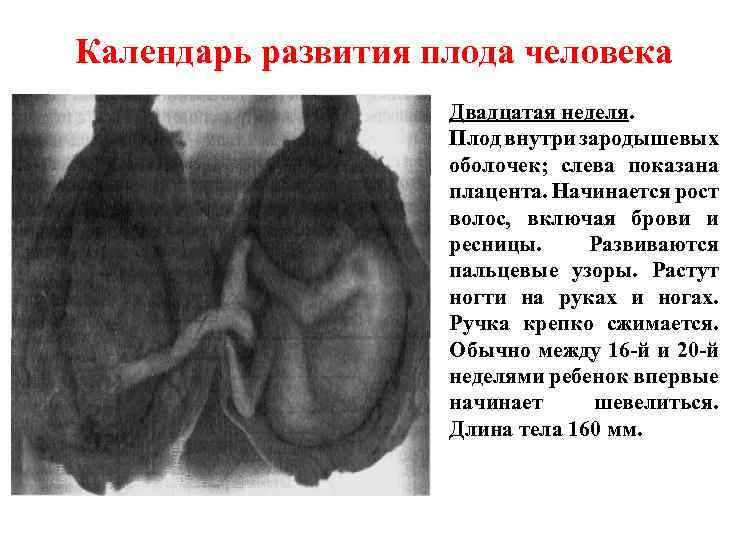 Календарь развития плода человека Двадцатая неделя. Плод внутри зародышевых оболочек; слева показана плацента. Начинается