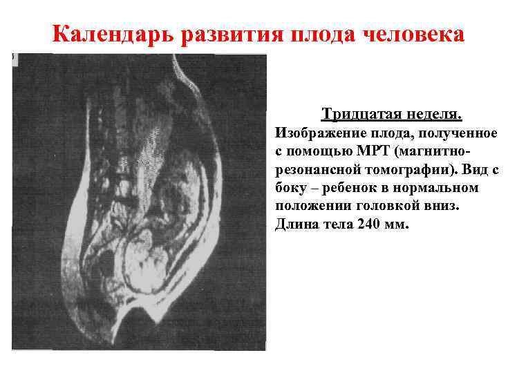 Календарь развития плода человека Тридцатая неделя. Изображение плода, полученное с помощью МРТ (магнитнорезонансной томографии).