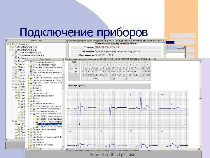 Подключение приборов Просмотр результата на Рабочем столе Назначение исследования на Рабочем столе Результат ЭКГ.