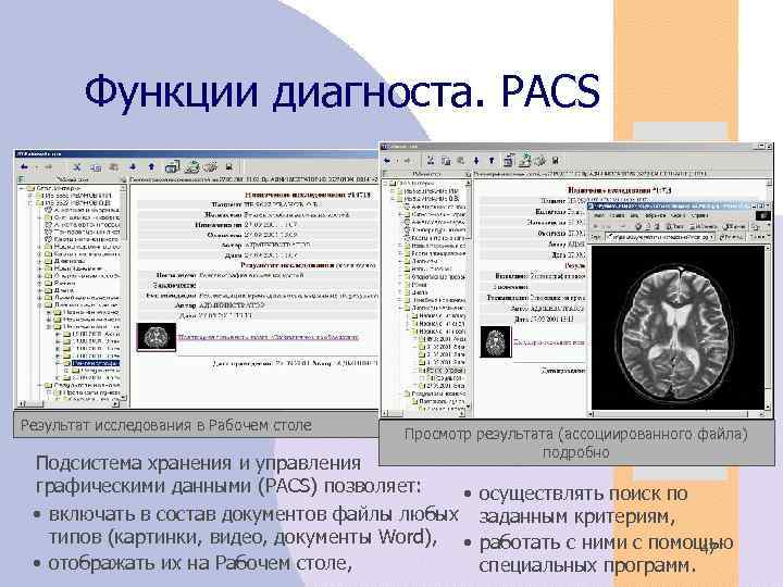 Функции диагноста. PACS Результат исследования в Рабочем столе Просмотр результата (ассоциированного файла) подробно Подсистема