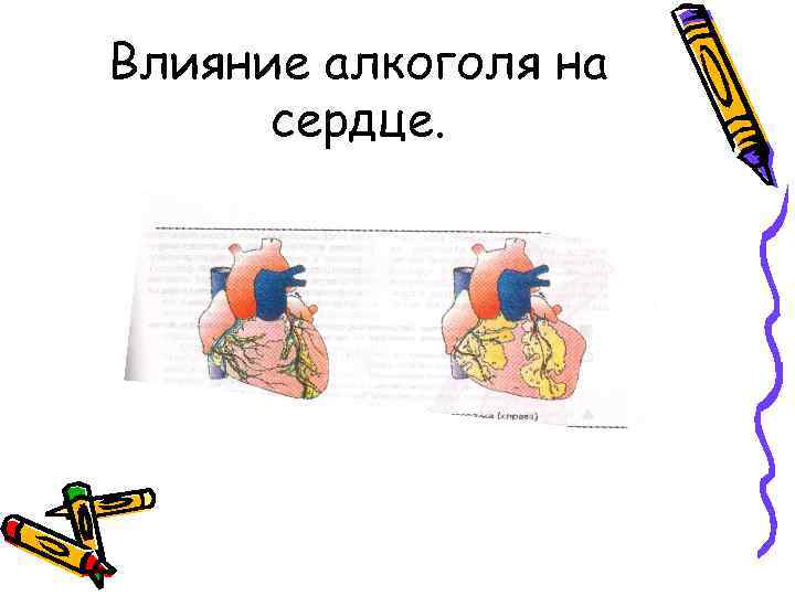 Влияние алкоголя на сердце. 