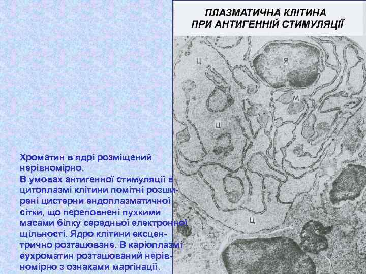 Хроматин в ядрі розміщений нерівномірно. В умовах антигенної стимуляції в цитоплазмі клітини помітні розширені