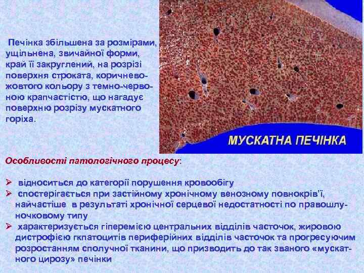 Печінка збільшена за розмірами, ущільнена, звичайної форми, край її закруглений, на розрізі поверхня строката,