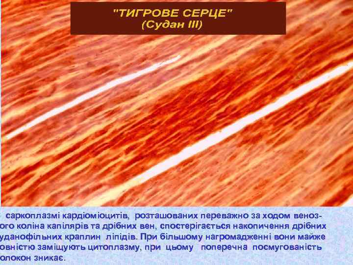 В саркоплазмі кардіоміоцитів, розташованих переважно за ходом венозого ного коліна капілярів та дрібних вен,