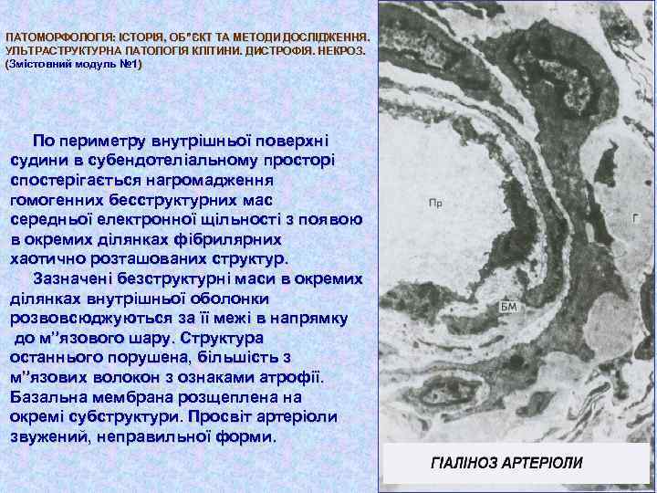 ПАТОМОРФОЛОГІЯ: ІСТОРІЯ, ОБ”ЄКТ ТА МЕТОДИ ДОСЛІДЖЕННЯ. УЛЬТРАСТРУКТУРНА ПАТОЛОГІЯ КЛІТИНИ. ДИСТРОФІЯ. НЕКРОЗ. (Змістовний модуль №