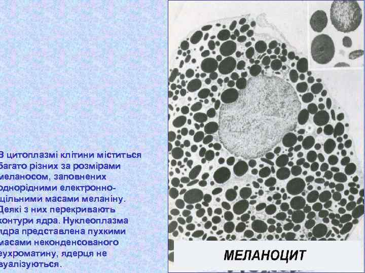 В цитоплазмі клітини міститься багато різних за розмірами меланосом, заповнених однорідними електроннощільними масами меланіну.