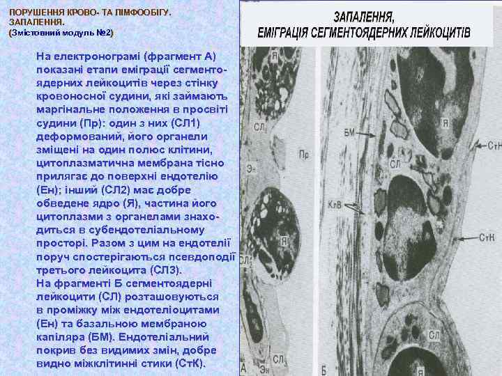 ПОРУШЕННЯ КРОВО- ТА ЛІМФООБІГУ. ЗАПАЛЕННЯ. (Змістовний модуль № 2) № 2 На електронограмі (фрагмент